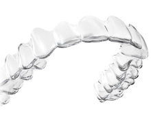 インビザラインのイメージ